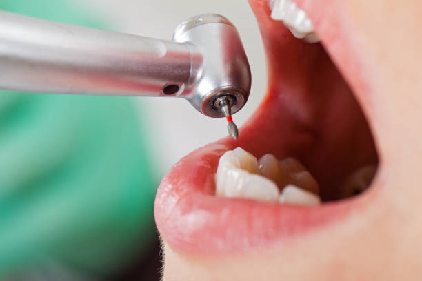 Best Walk-In Emergency Dental Services in Justice, IL